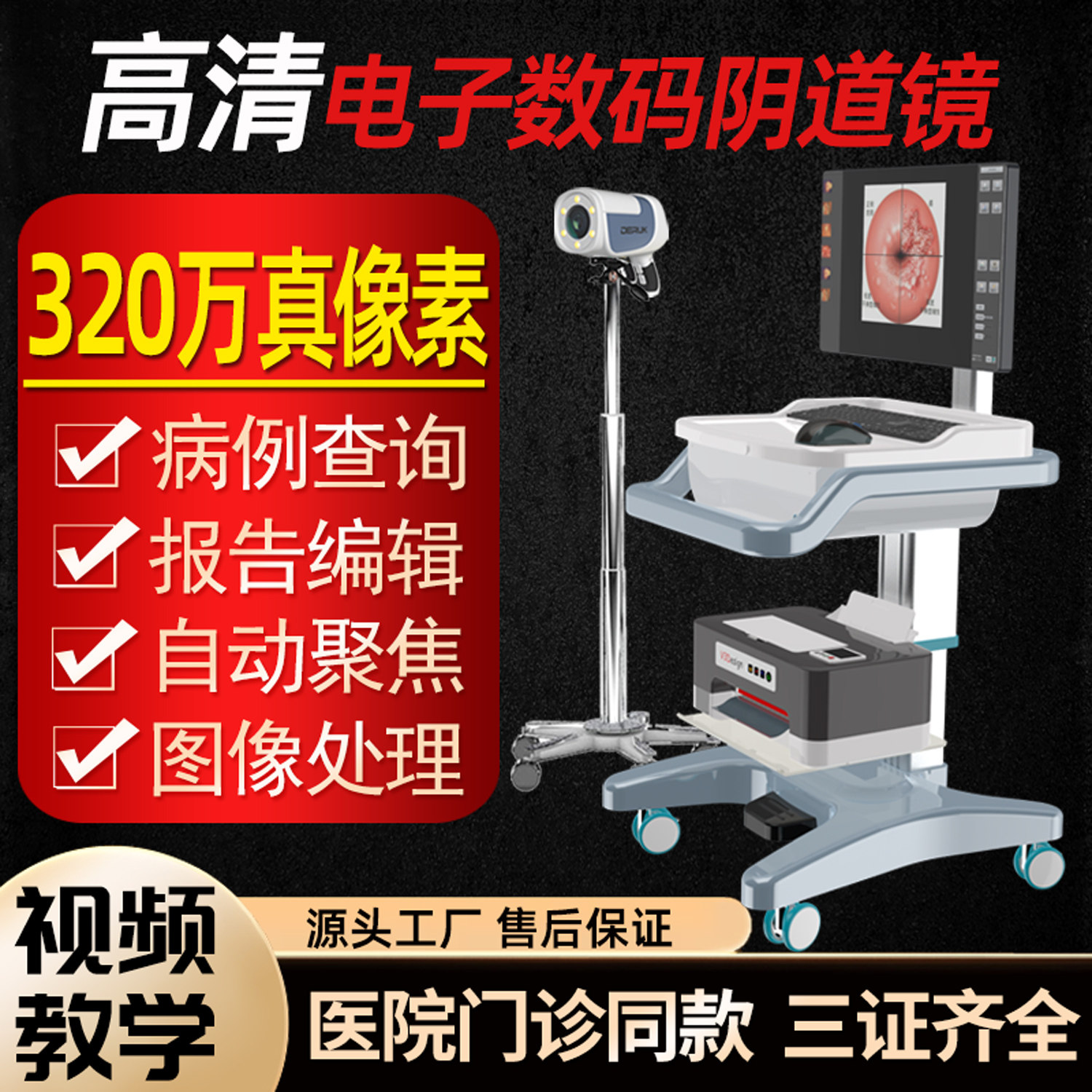 医院门诊高清电子阴道镜 进口数码宫颈内窥镜 妇科私密检查仪整套