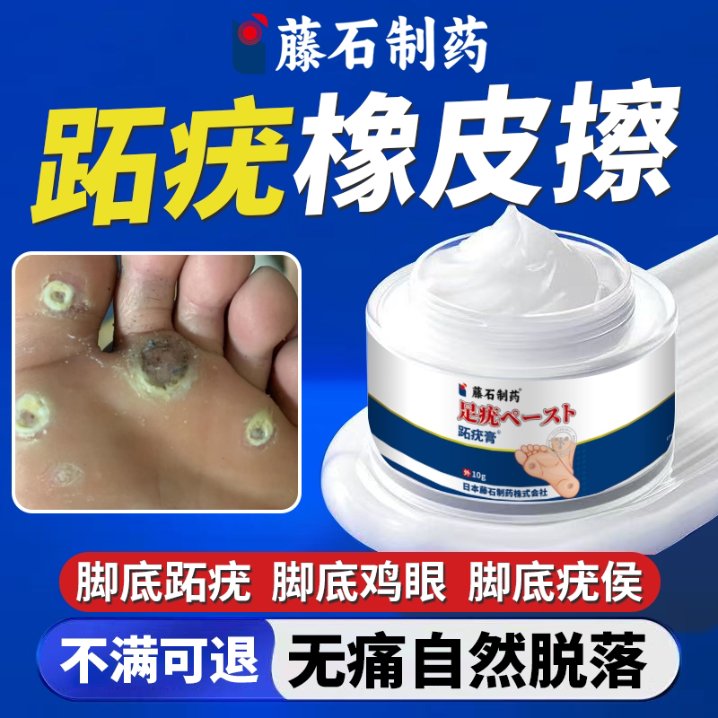 跖疣膏专用膏去寻常疣根病毒拓趾保健理疗