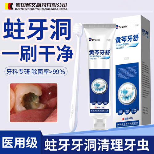 蛀牙牙洞清理牙虫的药蛀牙虫牙专用药牙膏防蛀牙龋齿修复KT