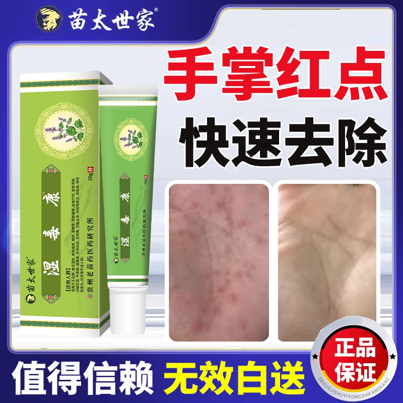 手掌手心红点真菌感染手痒手气起皮肤消毒护理（消）