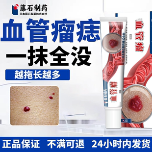 血管瘤血管痣去除专用药膏樱桃状血管瘤点红痣血管痣马保健护理KT