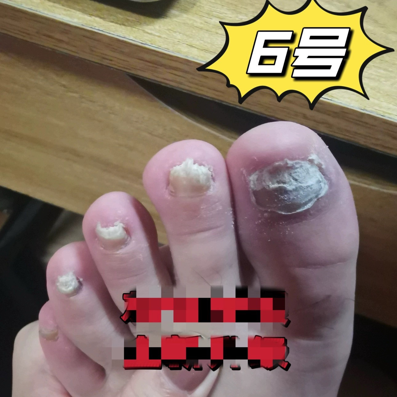 灰9