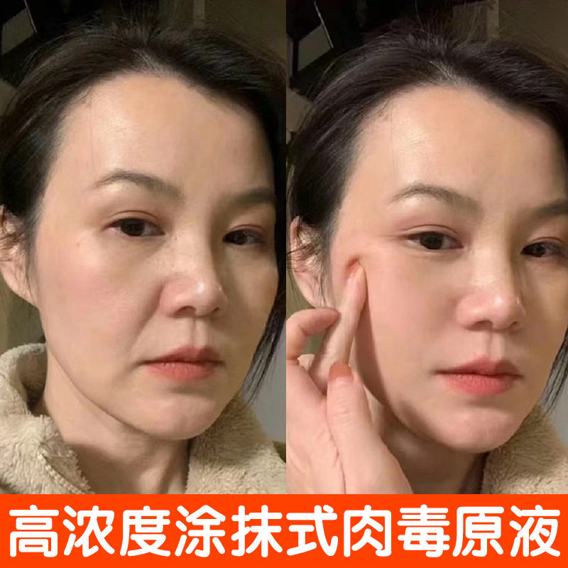 涂抹式类肉毒杆肉毒原液淡化细纹混合性肤质液态精华