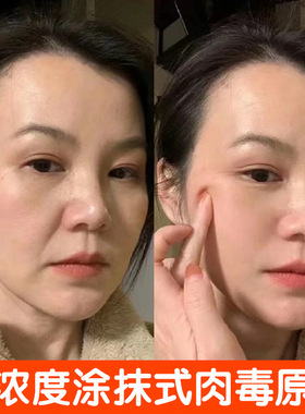 涂抹式类肉毒杆肉毒原液抗皱紧致精华液去抬头细纹多肽肉毒精华液