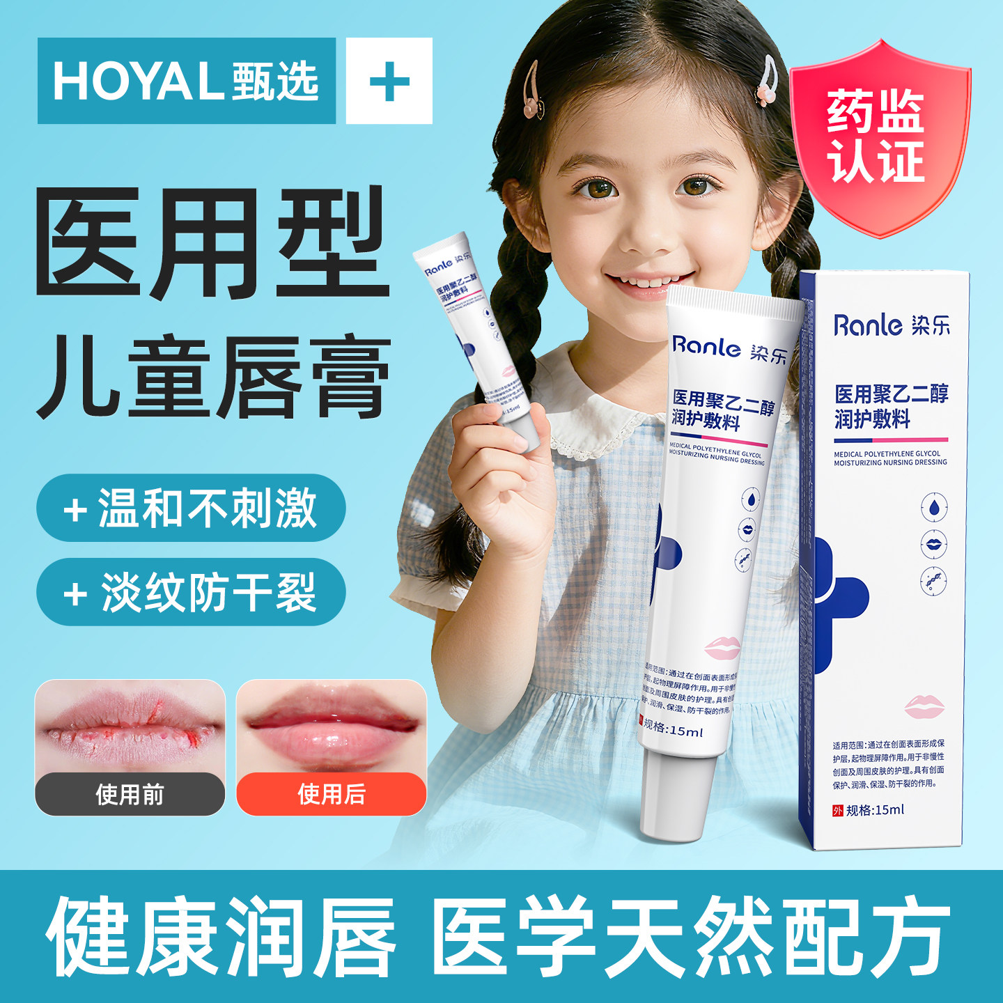医用型儿童唇炎嘴唇干裂脱皮专用润唇膏修护宝宝口角炎烂嘴角保湿