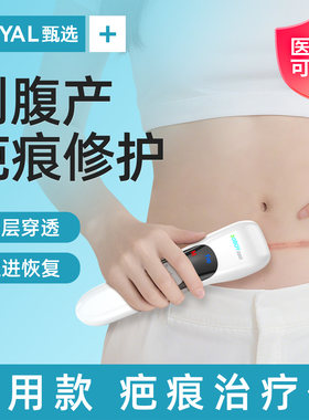【院款疤痕】医用超声波治疗仪