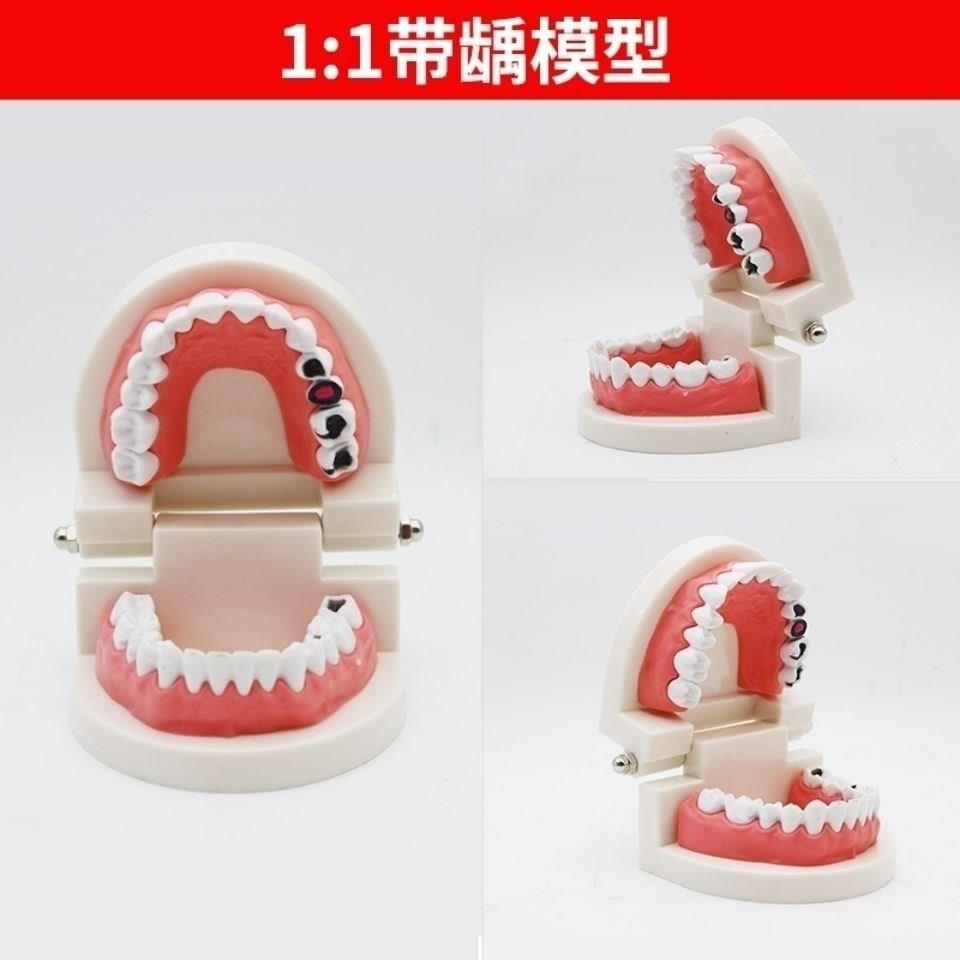 假牙模型模具牙齿模型幼儿园宝宝学刷牙玩具牙齿模型口腔教学标准