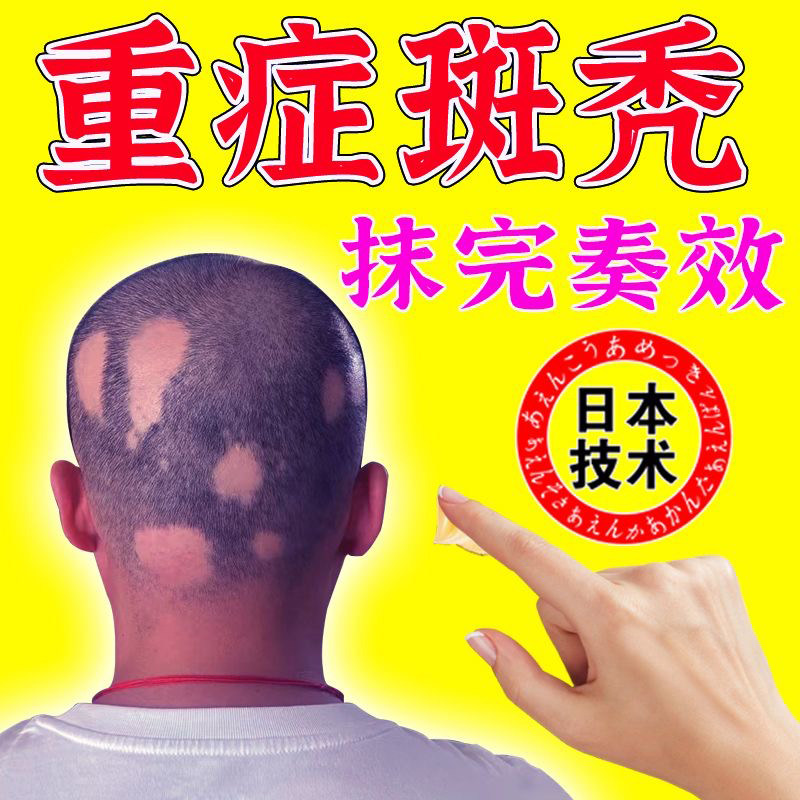 补肾乌发丸固肾生发丸 同仁堂益肾口服液固发生发内调防脱秃头