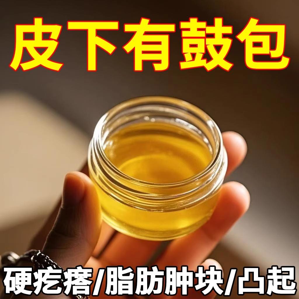 脂肪康正品肿块膏脂肪灵瘤膏皮下硬块鼓包单发性多发性涂抹膏