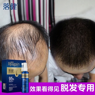 落健生长液男脂溢性脱发增长发际线增发长发液毛液斑秃掉发谢顶育