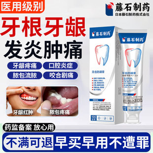 根尖周炎专用非牙膏牙龈脓包牙根尖炎急性牙周炎神器咬合肿痛SK