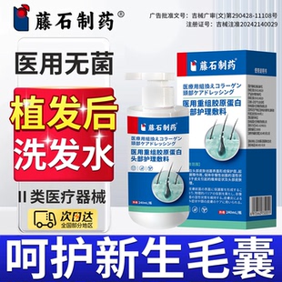 植发后专用洗发水术后护理营养液生发液改善头皮毛囊温和无刺激RW