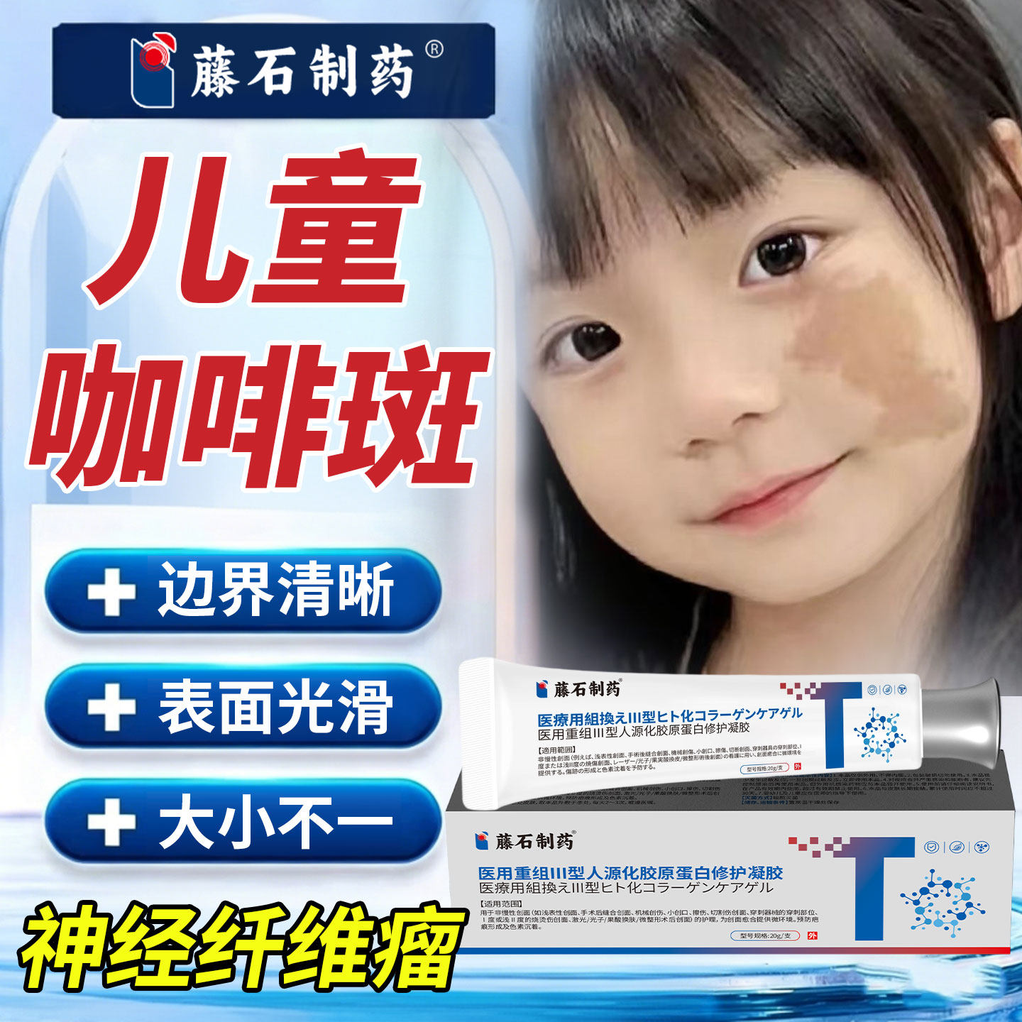 儿童牛奶咖啡斑胎记去除神经纤维瘤药监备案膏激光去皮肤黑色素SA