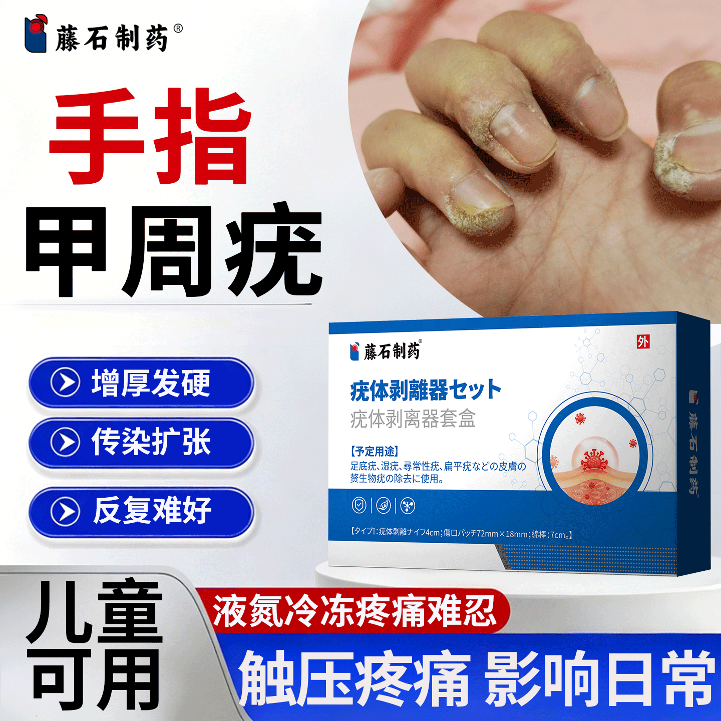 手指甲周疣手上长硬疙瘩去儿童寻常疣除刺猴子根防复发hpv疣药JI