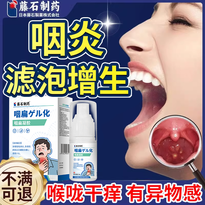 滤泡增生咽炎咽喉炎慢性咽炎咽后壁淋巴舌根喉咙发炎异物感喷剂CA