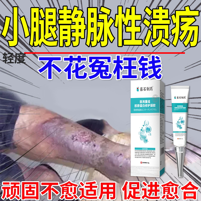 小腿静脉性溃疡血栓脉管炎老烂腿发黑专用静脉曲张溃烂药房同售CA - 实物图