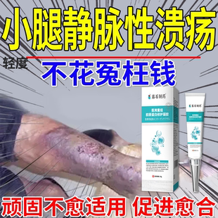 小腿静脉性溃疡血栓脉管炎老烂腿发黑专用静脉曲张溃烂药房同售CA