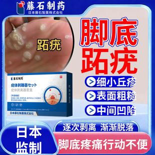 脚底长跖疣专用膏去药房同售根可搭配碘酊液氮冷冻去跖疣医用CA