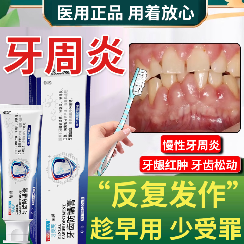 牙周炎症牙龈肿痛出血用