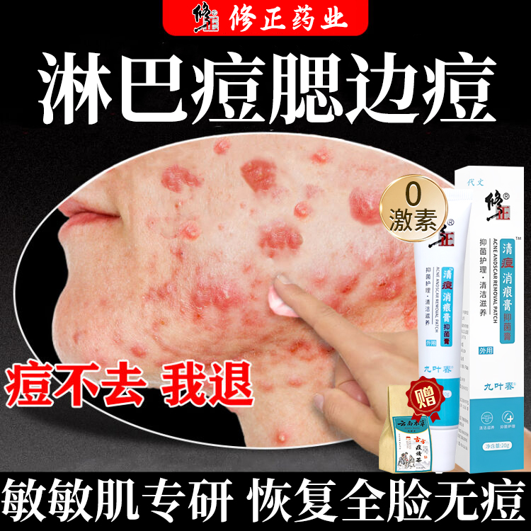 淋巴痘腮边痘结节硬块痘豆豆贴修复消炎痘印医用却痘印痘坑修复js