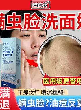 祛螨虫洗面奶女脸部干痒油痘肌除螨洁面乳止痒清洁毛孔痤疮痘SK
