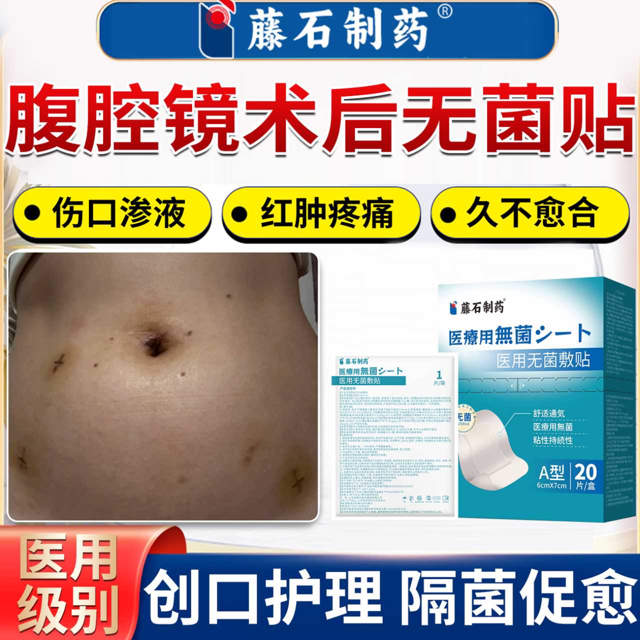 腹腔镜术后伤口防水贴阑尾炎微创医用无菌敷料低敏透气护理贴YI
