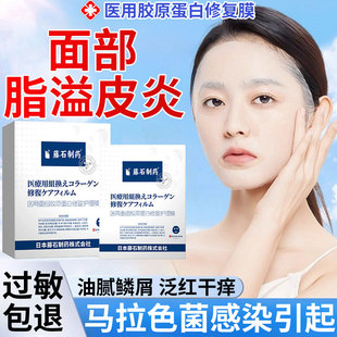脂溢性皮炎面部鼻子两侧马拉色菌医用泛红修复脸颊干燥起皮面膜SK