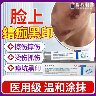 擦伤摔伤结痂后疤痕去黑印色素沉淀脸上指甲抓伤祛痘印湿疹去除VX