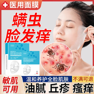 脸部上起小疙瘩瘙痒除螨虫止痒药房同售颗粒长痘丘疹清洁膏面膜SK