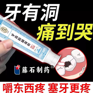 医用儿童搭牙凝胶膏防蛀牙龋齿修6到12岁含氟换牙期防蛀固齿复CA