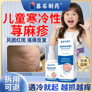 儿童寒冷性荨麻疹喷剂过敏止痒抑菌风团湿疹皮肤瘙痒药房同售VX