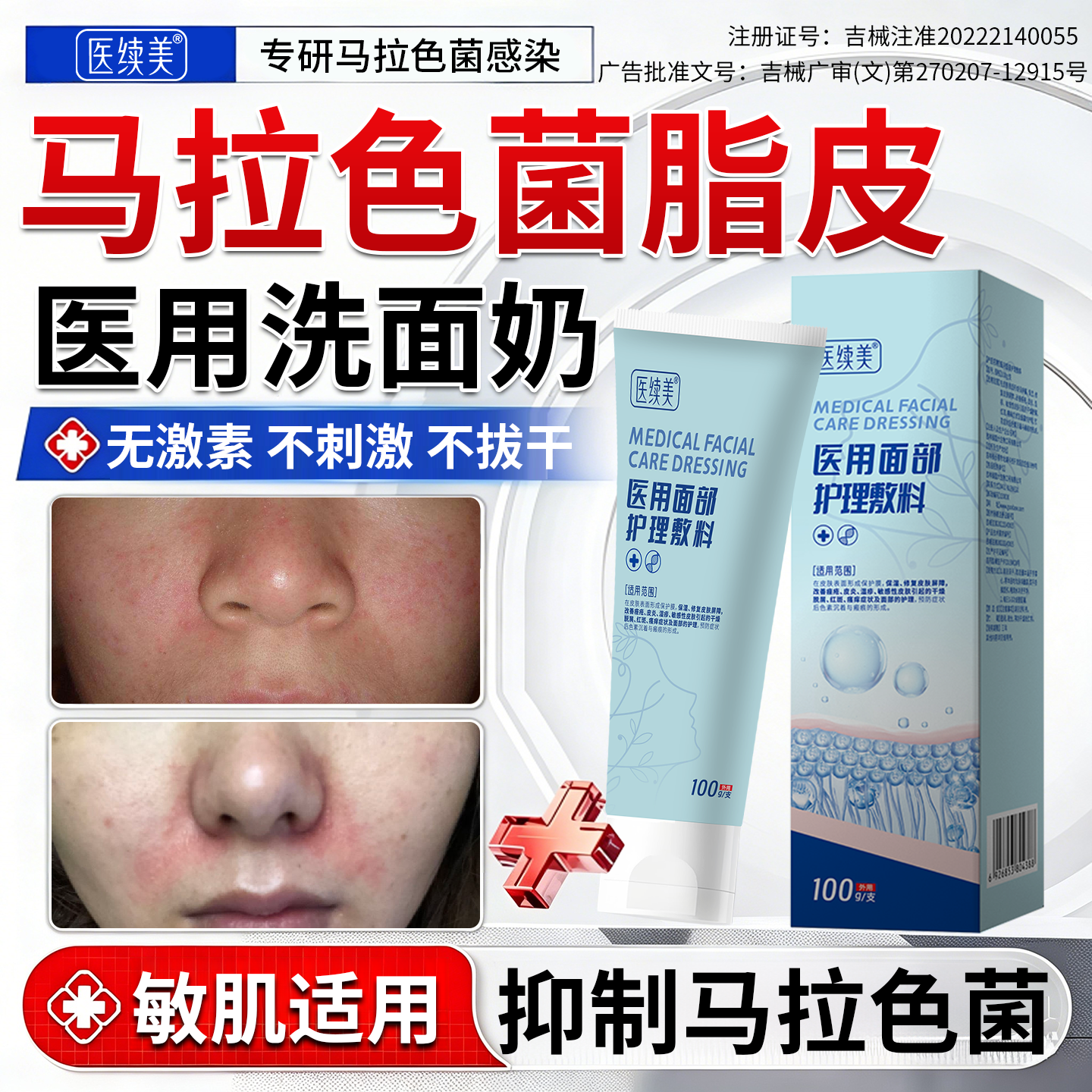 马拉色菌脂溢性皮炎洗面奶面部修复护肤品医用清洁抗菌控油祛痘RW
