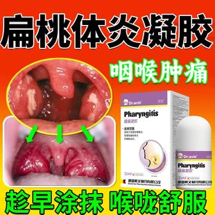 咽喉扁桃体炎凝胶喉咙肿痛扁桃体发炎化脓专外用药房同售肥大CA