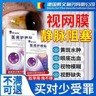 视网膜静脉阻塞眼底黄斑病变出血眼去除睛水肿叶黄素冰敷眼贴CA