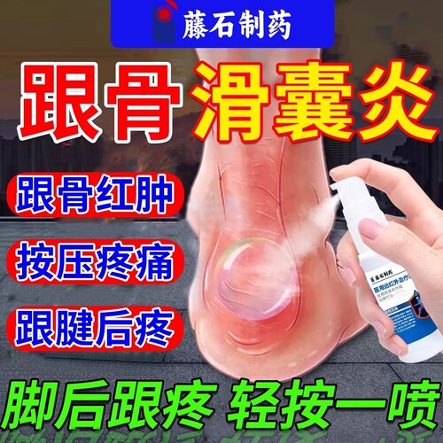 足跟骨后滑囊炎专贴膏用跟腱足跟痛脚后跟疼积水消肿止痛喷雾剂RW