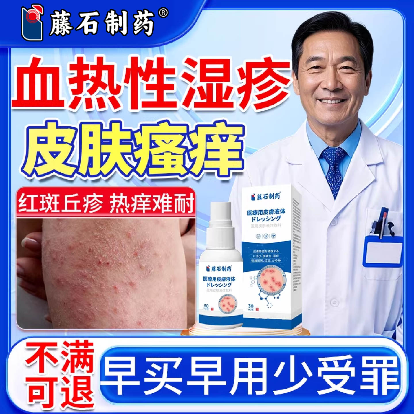 血热性型湿疹皮肤一热瘙痒抑菌止痒膏真菌感染红斑水泡热毒湿疹SK