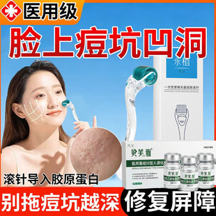 脸上祛痘坑凹洞修复生长因子导入胶原蛋白精华液填充再生医用级SK