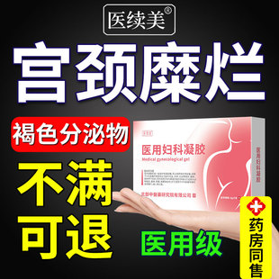 阴道褐色分泌物多白带多有红血丝量多出血异味宫颈糜烂妇科凝胶SK