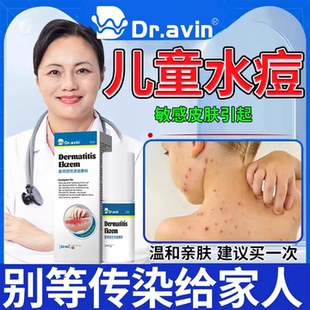 儿童水痘止痒搭藤石制药带状疱疹膏喷剂水痘外用膏疤痕去水痘坑CA