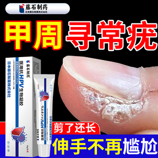 手上寻常疣甲周疣专用去手指上长疣硬疙瘩膏甲下疣膏药房同售QK
