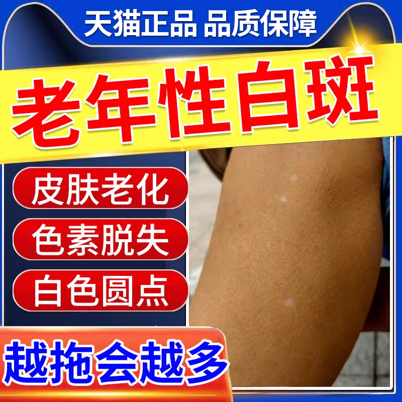 老年性白斑黄褐斑老年斑强力去凝胶专用手背部脸部白点药房同售CA