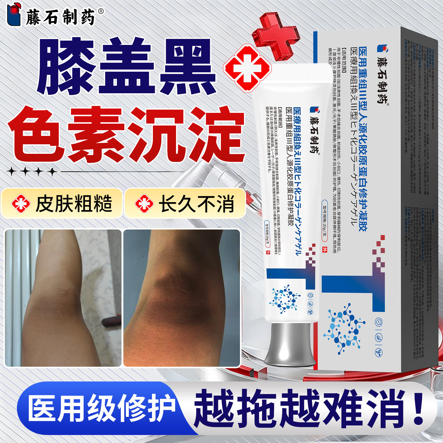 膝盖黑色素沉淀去除关节黑美白去死皮变白神器手胳膊肘退褪黑膏SA