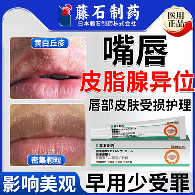 皮脂腺异位症嘴唇白点脂肪小颗粒疱疹去干裂脱皮增生除药房同售CA