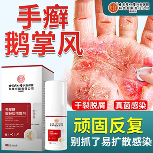 手癣膏脱皮干裂真菌感染藓鹅掌风喷剂湿疹止痒去一次净药房同售RW