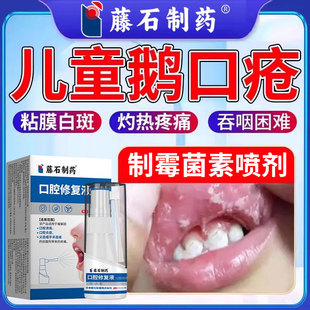 鹅口疮专用可搭制霉菌素喷剂含漱液漱口水碳酸氢钠的药房同售CA