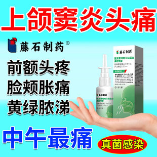 牙源性真菌性上颌窦炎头痛脑胀急慢性鼻额窦炎喷剂鼻塞鼻臭鼻炎CA