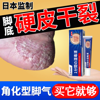 角化型脚气脚后跟干裂真菌感染湿疹膏药房同售起硬皮足跟开裂底ef