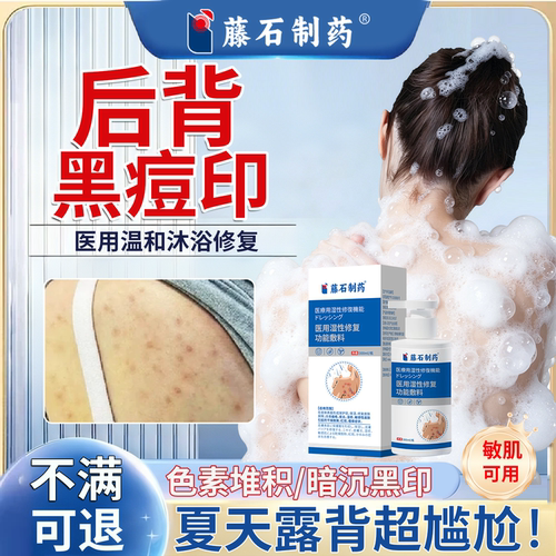 后背黑痘印去除淡化黑色素沉淀疤痕修复祛黑印医用修复沐浴敷料TZ