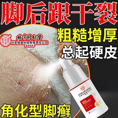 脚后跟干裂真菌感染鳞屑角化型脚气开起硬皮足跟足癣脚癣净喷剂CA