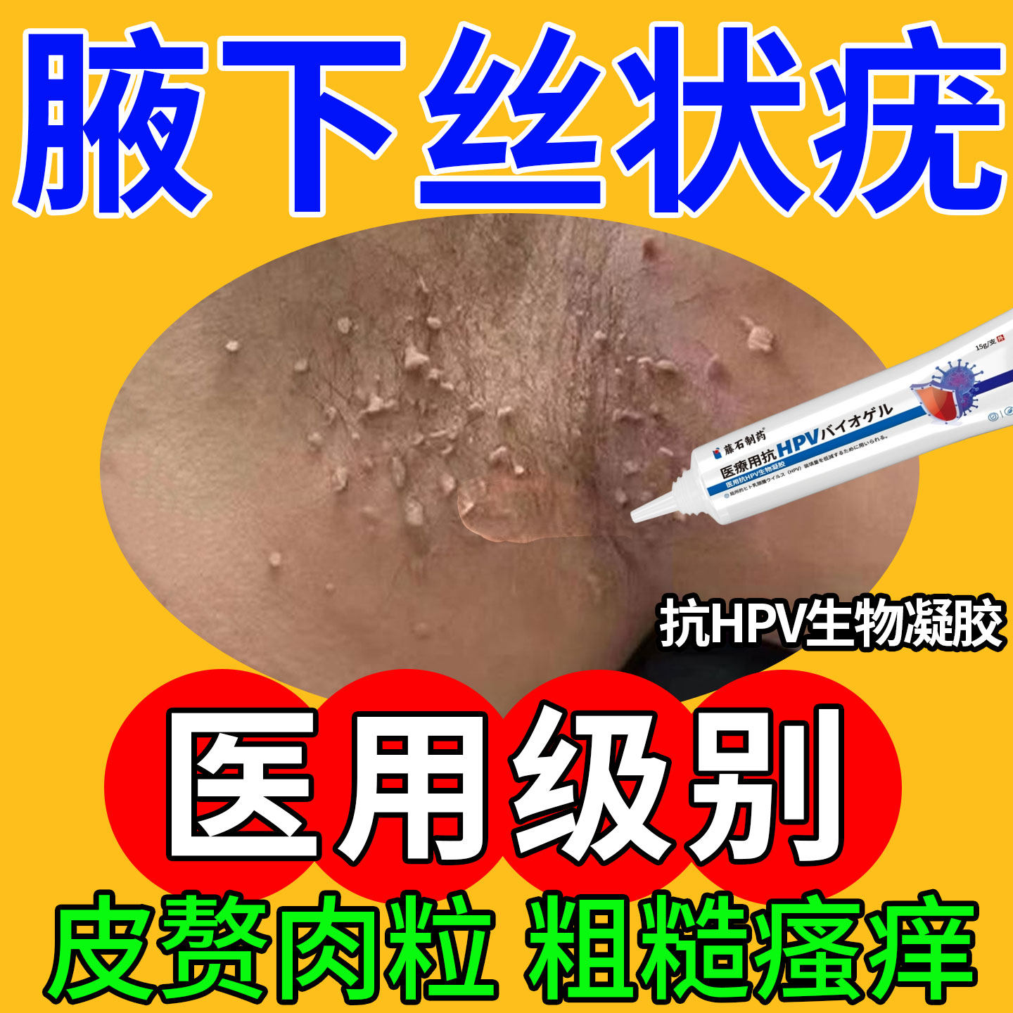 腋下丝状疣去扁平疣除神器颈部长小肉粒疙瘩专用皮赘点疣膏医用SK